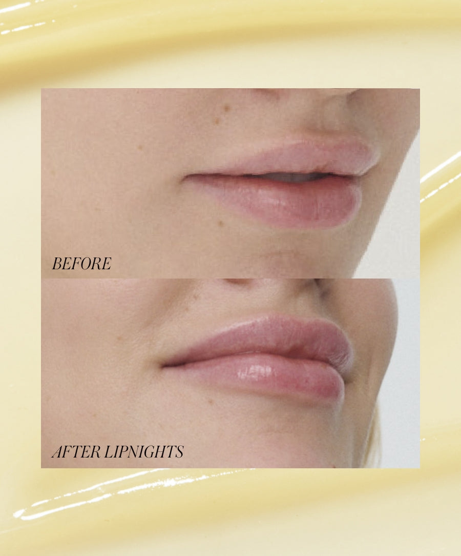Lipnights Overnight Lip Mask - Everyday Beauty Essential